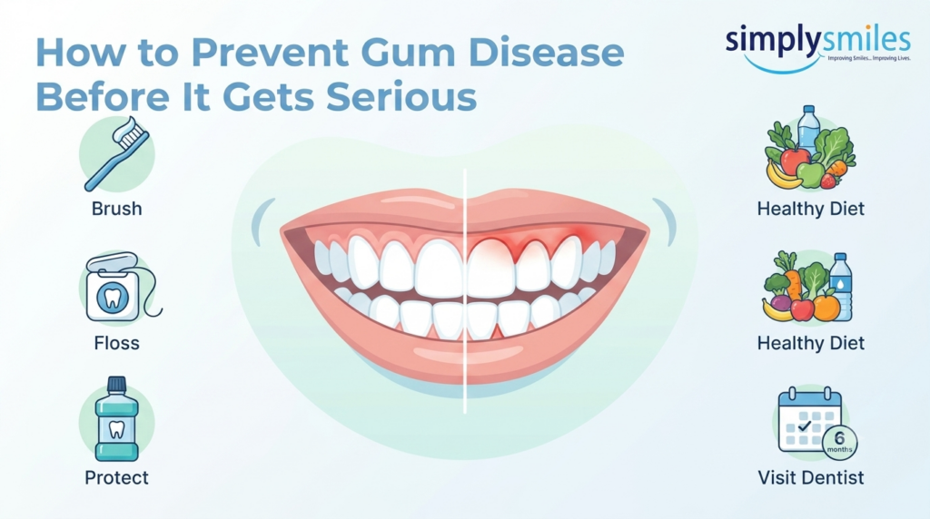 How to Prevent Gum Disease Before It Gets Serious