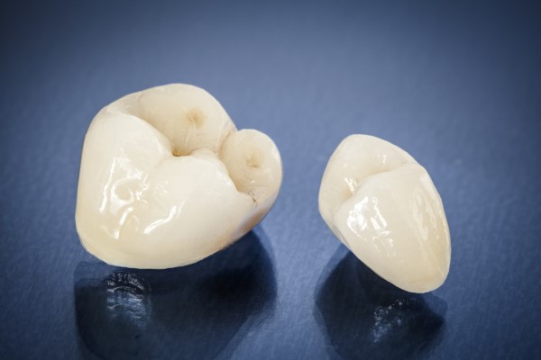 How Long Is The Process For Placing Implant Crowns?